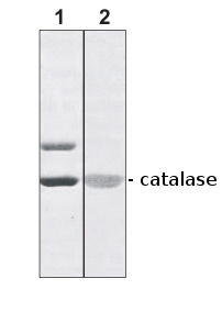 western blot using anti-catalase antibodies 